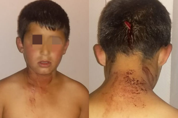 Bakıda atanın 11 yaşlı oğlunu başından bıçaqlaması ilə bağlı araşdırma başladı